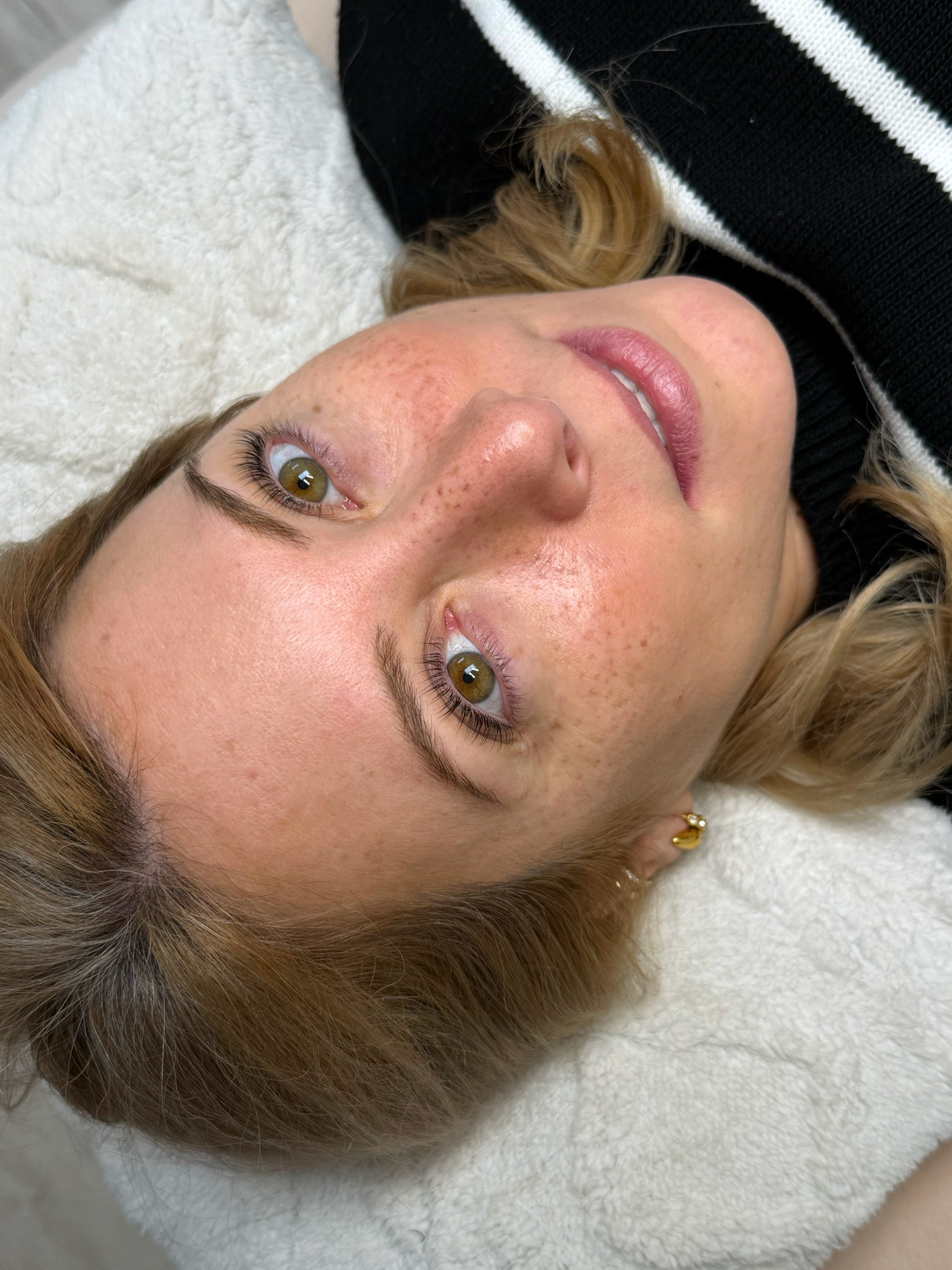 IMG_0009 Fausses taches de rousseur en dermopigmentation à Eysines